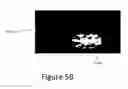 Fig. 08 - Geographic atrophy identification and measurement