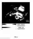 Fig. 05 - REVERSIBLY SWITCHABLE PHOTOACOUSTIC IMAGING SYSTEMS AND METHODS