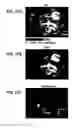 Fig. 26 - REVERSIBLY SWITCHABLE PHOTOACOUSTIC IMAGING SYSTEMS AND METHODS