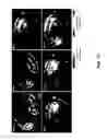 Fig. 29 - REVERSIBLY SWITCHABLE PHOTOACOUSTIC IMAGING SYSTEMS AND METHODS
