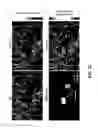 Fig. 49 - REVERSIBLY SWITCHABLE PHOTOACOUSTIC IMAGING SYSTEMS AND METHODS