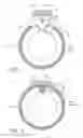 Fig. 02 - Implantable vital sign sensor