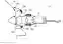 Fig. 01 - Method and system for determining intracranial pressure