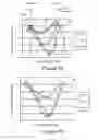 Fig. 07 - Method and system for determining intracranial pressure