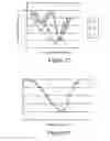 Fig. 08 - Method and system for determining intracranial pressure