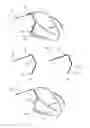 Fig. 01 - DEVICE FOR DETERMINING A SPECIFIC POSITION OF A CATHETER