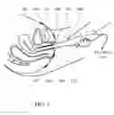 Fig. 02 - Methods and probes for vaginal tactile and electromyographic imaging and location-guided female pelvic floor therapy