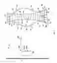 Fig. 02 - SYSTEMS AND METHODS FOR FAILURE DETECTION OF ENDOVASCULAR STENTS