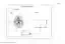 Fig. 01 - METHOD AND SYSTEM FOR DETECTING AND ASSESSING BRAIN INJURIES USING VARIABILITY ANALYSIS OF CEREBRAL BLOOD FLOW VELOCITY