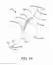 Fig. 03 - DEVICES AND SYSTEMS FOR INVERTING AND CLOSING THE LEFT ATRIAL APPENDAGE