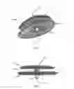 Fig. 03 - Occlusion device and method for its manufacture