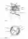 Fig. 04 - Occlusion device and method for its manufacture