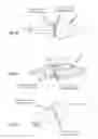 Fig. 06 - Occlusion device and method for its manufacture