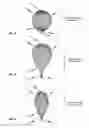 Fig. 07 - Occlusion device and method for its manufacture