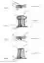 Fig. 09 - Occlusion device and method for its manufacture