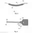 Fig. 07 - Soft tissue fixation devices