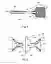 Fig. 10 - Soft tissue fixation devices