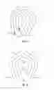 Fig. 03 - Staples and staple delivery and drill guides