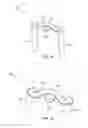 Fig. 08 - Staples and staple delivery and drill guides