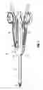 Fig. 02 - Surgical clip applier