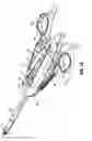 Fig. 03 - Surgical clip applier