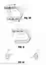 Fig. 10 - Surgical clip applier