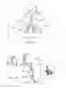 Fig. 02 - Cross-sectional modification during deployment of an elongate lung volume reduction device
