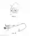 Fig. 05 - Cross-sectional modification during deployment of an elongate lung volume reduction device