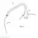 Fig. 06 - Cross-sectional modification during deployment of an elongate lung volume reduction device