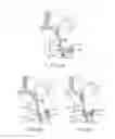 Fig. 09 - Cross-sectional modification during deployment of an elongate lung volume reduction device
