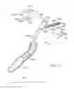 Fig. 17 - Cross-sectional modification during deployment of an elongate lung volume reduction device