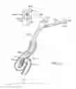 Fig. 18 - Cross-sectional modification during deployment of an elongate lung volume reduction device