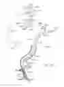 Fig. 19 - Cross-sectional modification during deployment of an elongate lung volume reduction device