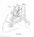 Fig. 22 - Cross-sectional modification during deployment of an elongate lung volume reduction device