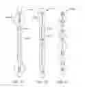 Fig. 33 - Cross-sectional modification during deployment of an elongate lung volume reduction device