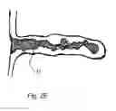 Fig. 08 - Atrial appendage occlusion systems and methods of using the same
