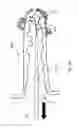 Fig. 11 - Atrial appendage occlusion systems and methods of using the same