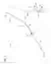 Fig. 02 - Tissue-removing catheter with improved angular tissue-removing positioning within body lumen