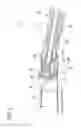 Fig. 03 - Tissue-removing catheter with improved angular tissue-removing positioning within body lumen