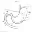 Fig. 10 - Puncture needle for endoscope and biopsy system