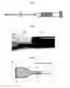 Fig. 02 - Systems and methods for percutaneous removal of objects from an internal body space