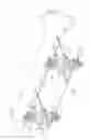 Fig. 02 - SINGLE LOCK EXTERNAL FIXATION CLAMP ARRANGEMENT AND METHOD