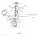 Fig. 04 - FACET JOINT REPLACEMENT INSTRUMENTS AND METHODS