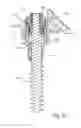 Fig. 22 - FACET JOINT REPLACEMENT INSTRUMENTS AND METHODS
