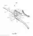 Fig. 43 - FACET JOINT REPLACEMENT INSTRUMENTS AND METHODS