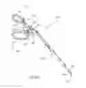 Fig. 47 - FACET JOINT REPLACEMENT INSTRUMENTS AND METHODS