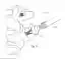 Fig. 52 - FACET JOINT REPLACEMENT INSTRUMENTS AND METHODS