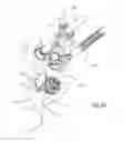 Fig. 67 - FACET JOINT REPLACEMENT INSTRUMENTS AND METHODS