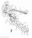 Fig. 04 - Orthopedic implant system
