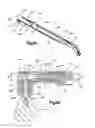 Fig. 06 - Orthopedic implant system